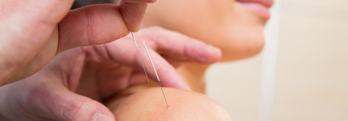 Chiropractic Sioux Falls SD acupuncture